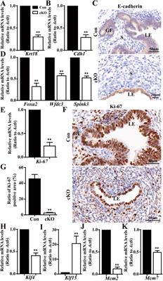 DCAF2 is essential for the development of uterine epithelia and mouse fertility